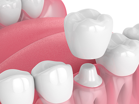 Jeansonne Spillers Dentistry