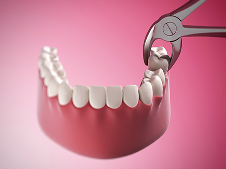 Jeansonne Spillers Dentistry