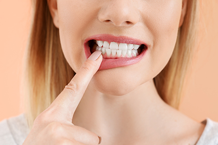 Jeansonne Spillers Dentistry